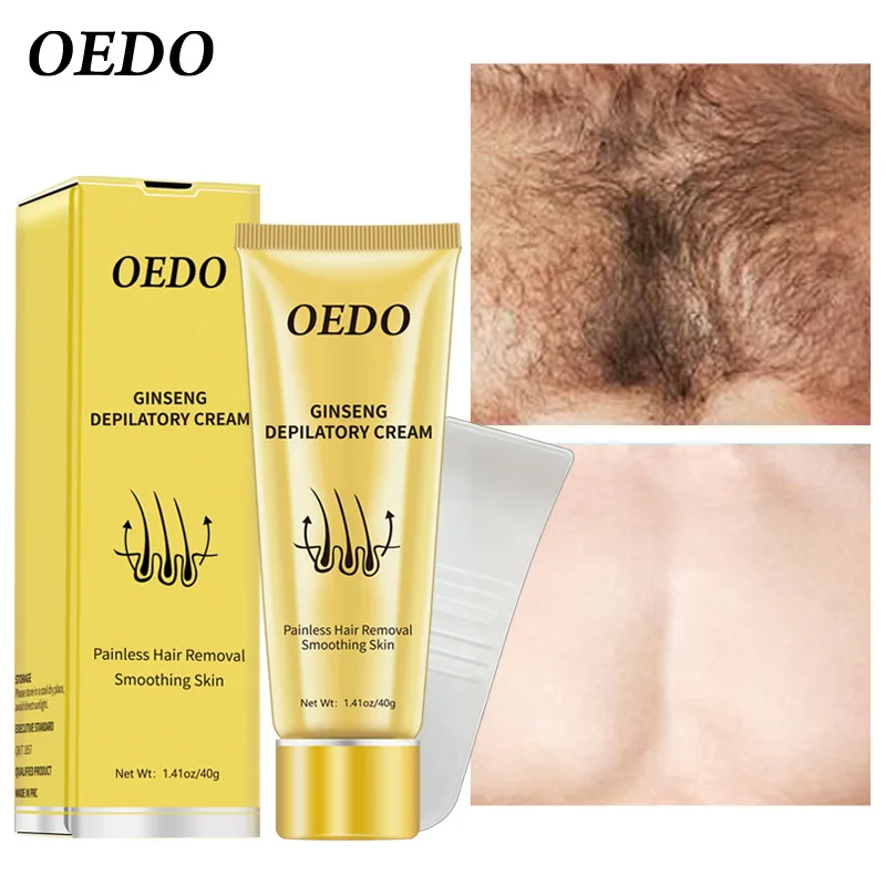 

OEDO Unisex Painless Depilatory Cream Legs Depilation Cream Hair Removal Men Women Armpit Legs Bikini Body Hair Remove