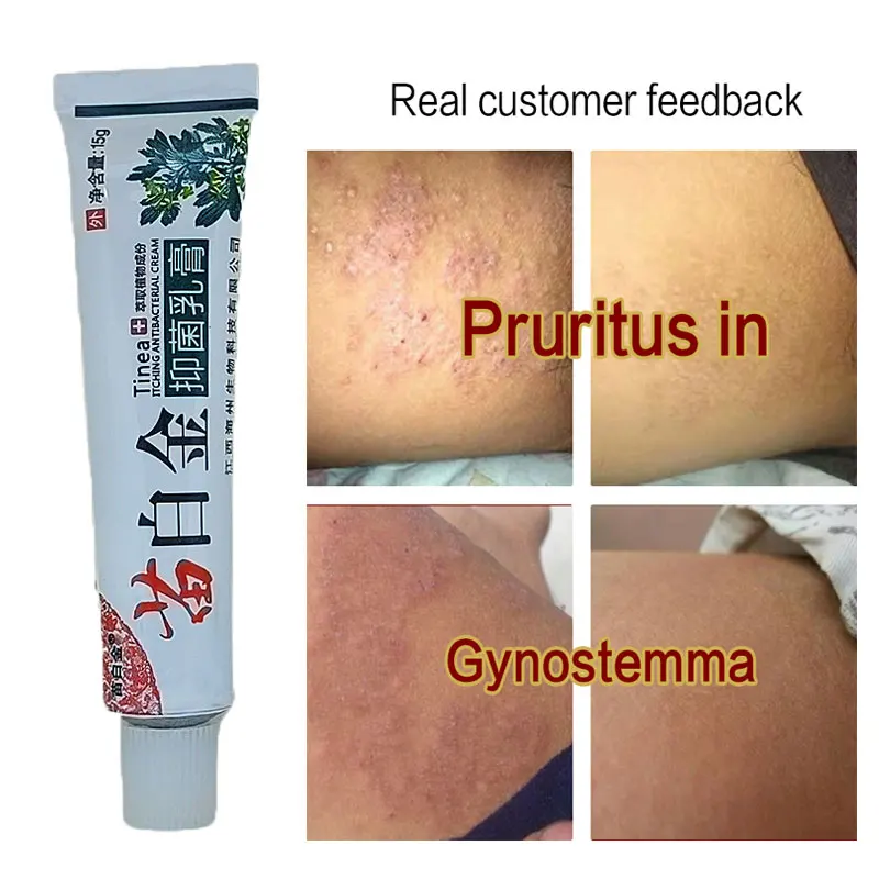 

Against Psoriasis Eczma Cream Natural Anti-Itch Eczematoid Urticaria Body Skin Treatment Herbal Ointment Antibacterial Gel