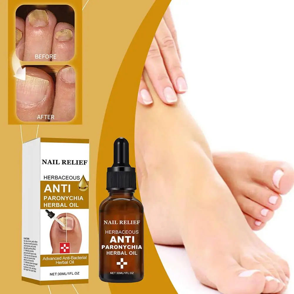 Средство для лечения Ногтей от грибков эссенция восстановления ногтей на ногах