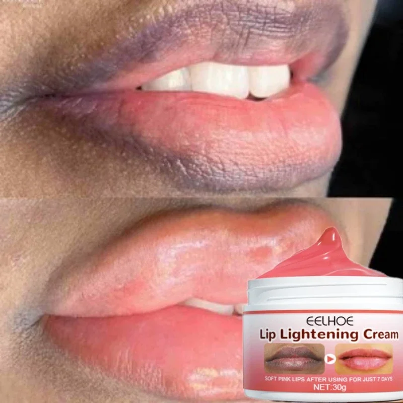 

Dark Lips Lightening Lip Balm Exfoliating Scrub Reduce Dull Pigmentation Products Deep Nourish Fade Lip Lines Korea Makeup Care