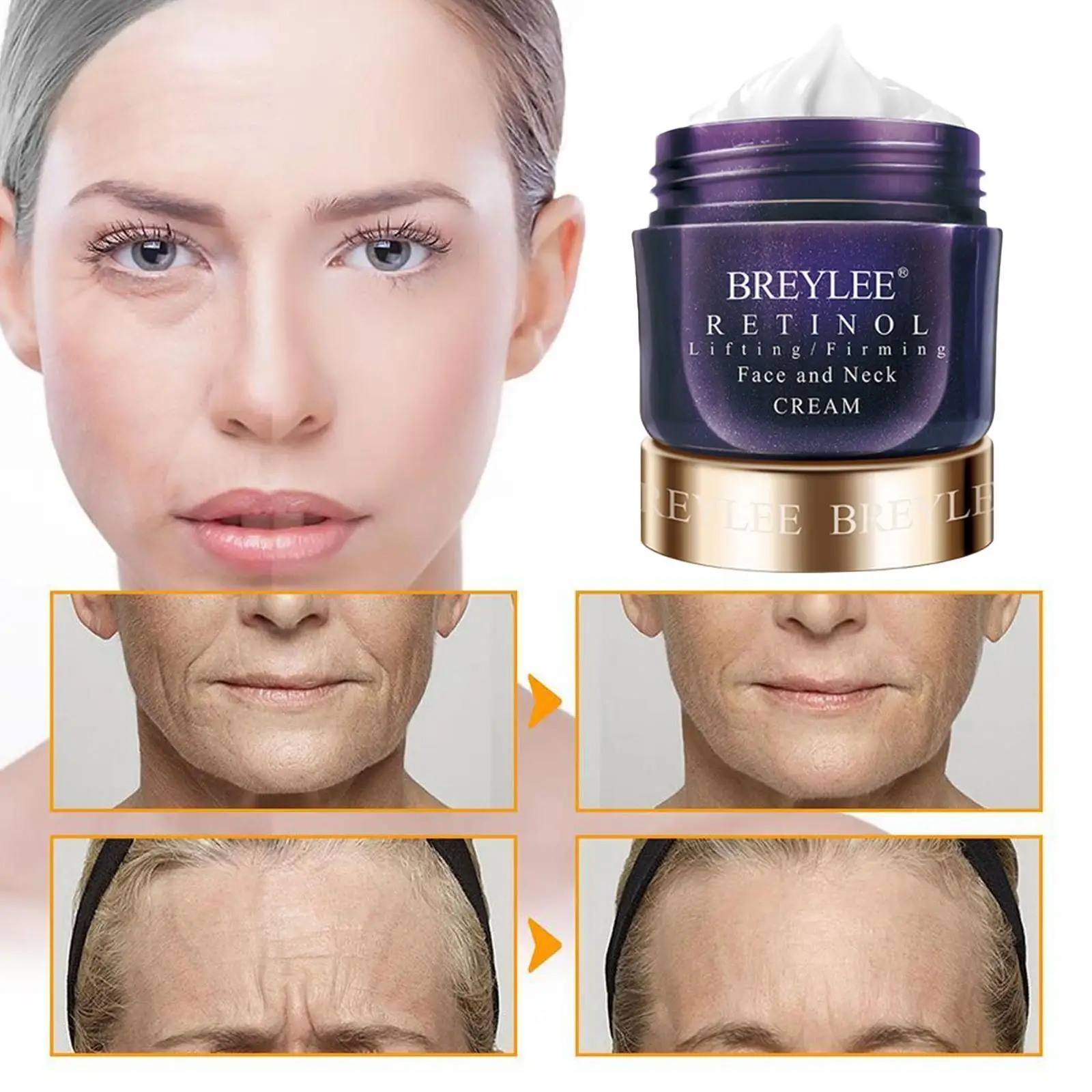 

BREYLEE Эл сенция для лица Retinol против морщин витамин с гиалуроновой кислотой Увлажняющий дневной крем отбеливание ухода за кожей лечение акне