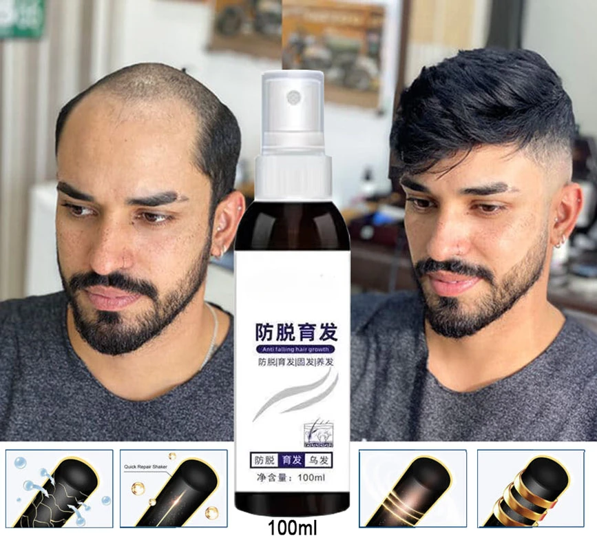 Спрей для роста волос 100 мл натуральный имбирь предотвращает выпадение и