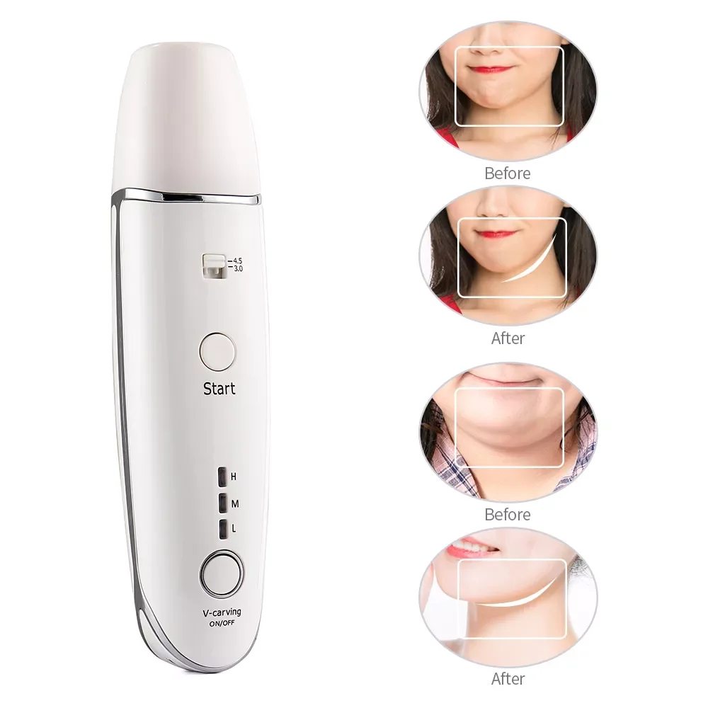 Mini Hifu Line V-shape Ultrasonic RF Face Liting Wrinkle Removal Anti-Aging Skin Revive Collagen Tighten Skin Care Beauty Device