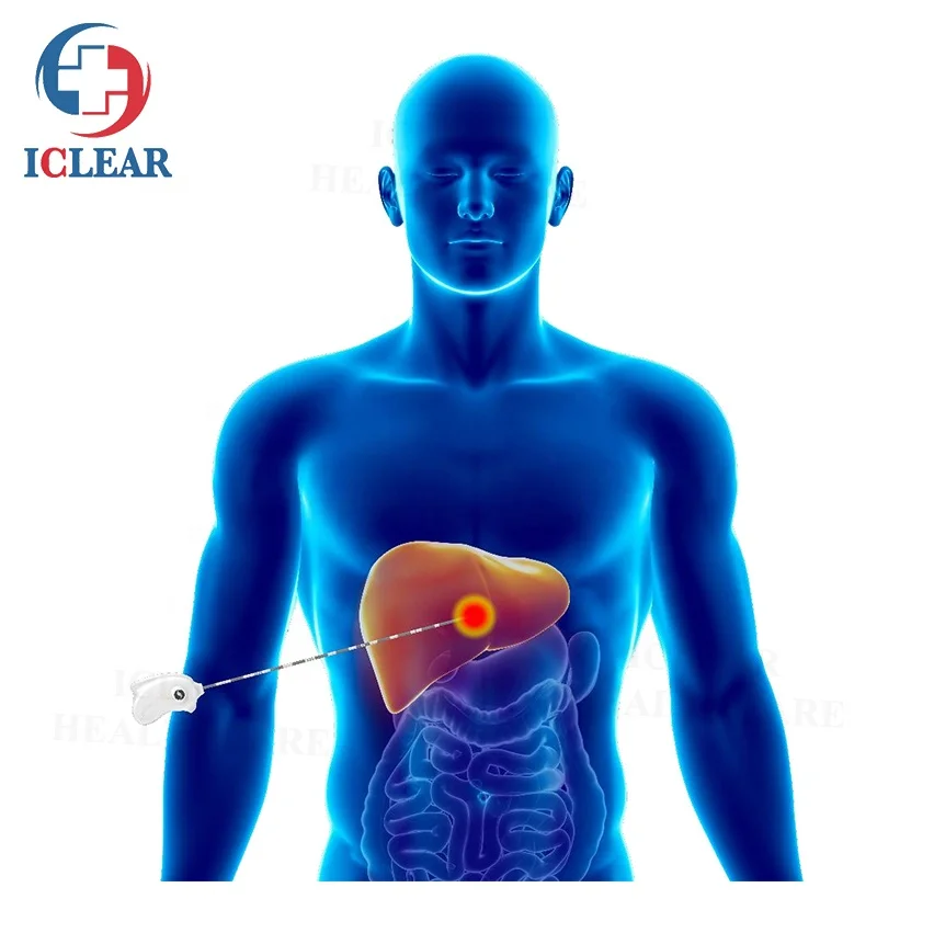Рисунок 5 - Аппарат для лечения раковой хирургии