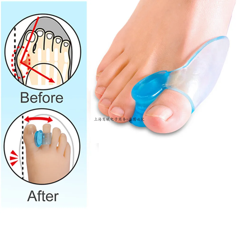 Silicone Gel 2pcs Thumb Corrector Bunion Little Toe Protector Separator Hallux Valgus Finger Straightener Foot Care Relief Pads |