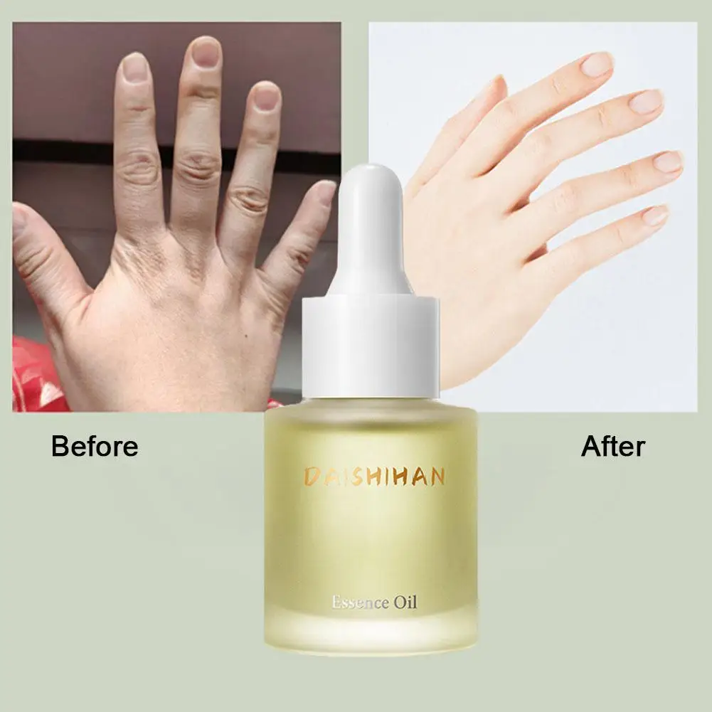 

Finger Slimming Serum Moisturizing Essential Oil Burn Finger Fat Anti-wrinkle Slim Fingers And Improve Roughness Cosmetics