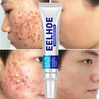 effective acne removal cream acne scar spots treatment oil control shrink pores whitening moisturizing face repair gel skin care