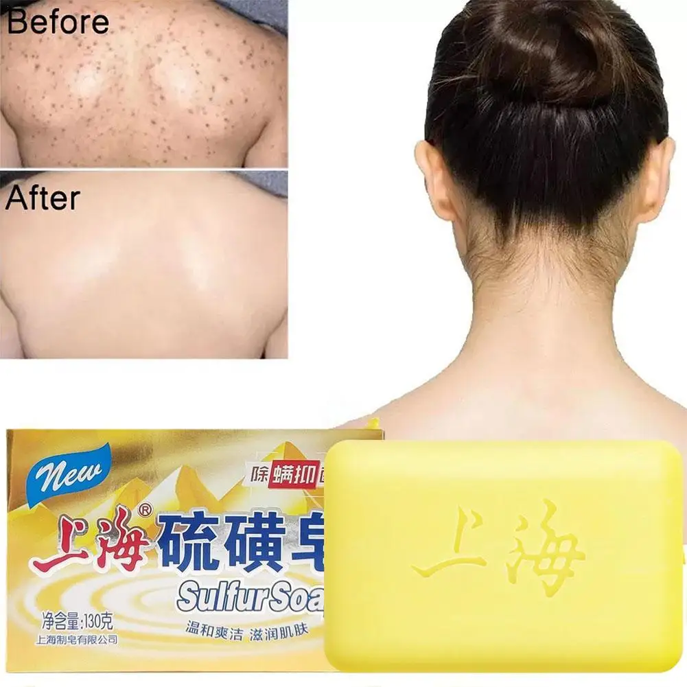 

130g Shanghai Sulfur Soap Acne Psoriasis 4 Skin Conditions Seborrhea Eczema Anti Fungus Perfume Butter Bubble Bath