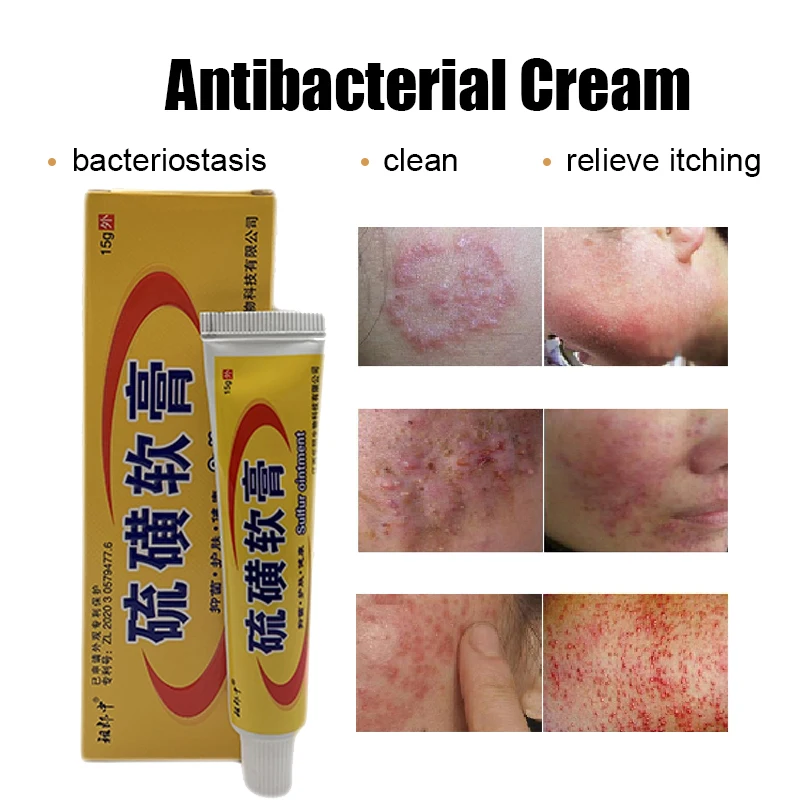 Серный антибактериальный крем псориаз экзема против зуда десквамация кожи уход