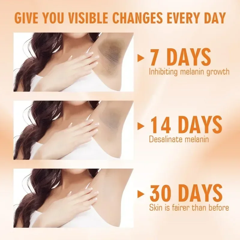 Крем с витамином C для осветления подмышек локтей коленей увлажняющий лосьон