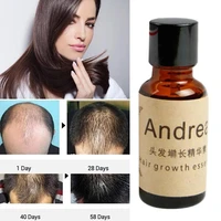 fast hair growth alopecia loss liquid ginger oil 20ml natural organic regrowth treatmenthair growth productsbeauty health