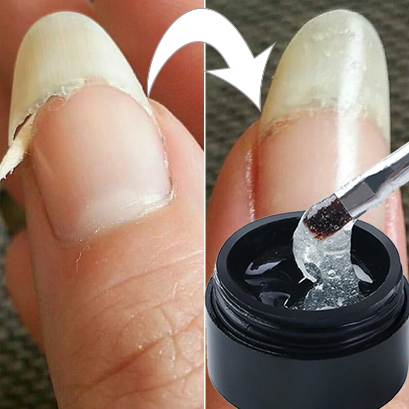 

5ml Transparent Nail Gel Extension Tips Varnish Acrylic Soak Off Repairing Broken Cracks Fiberglass UV Nail Gel Manicure Glue