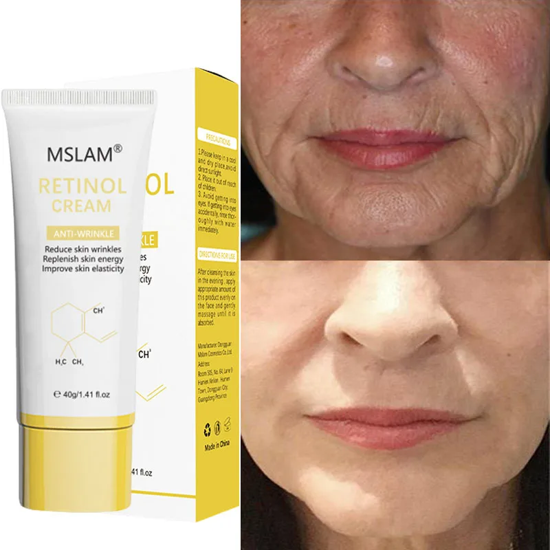 

Instant Wrinkle Remover Face Cream Fade Fine Lines Lift Firm Anti-Aging Facial Nourish Moisturize Korean Face Skin Care Products
