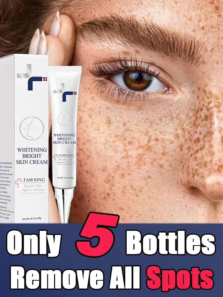 Отбеливающий крем для кожи против веснушек удаляет пятна меланина уменьшает