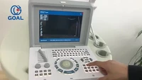 cheap ultrasound machinenotebook color doppler ultrasoundportable ultrasound