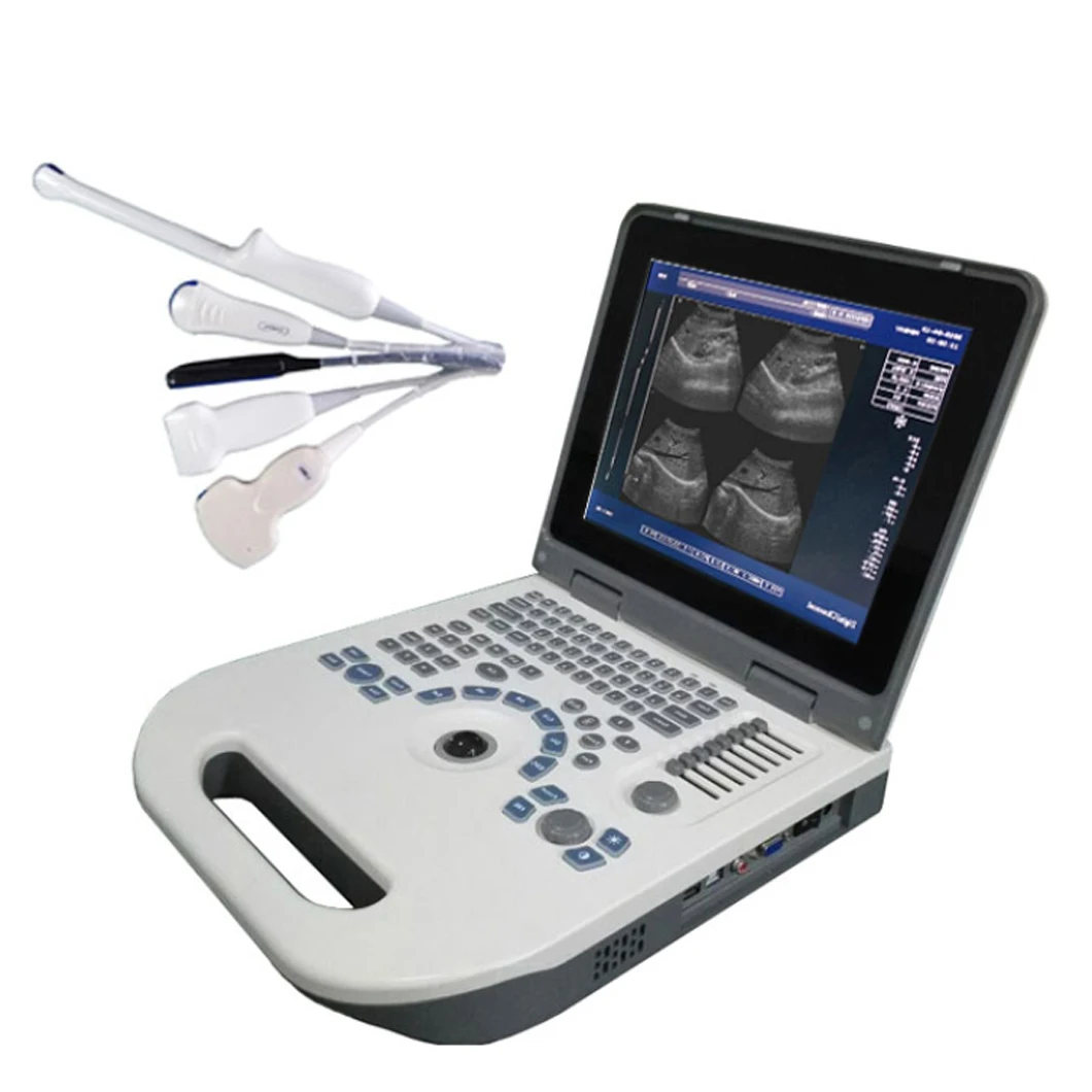 

Медицинское диагностическое оборудование по хорошей цене, портативный ультразвуковой аппарат для ноутбука