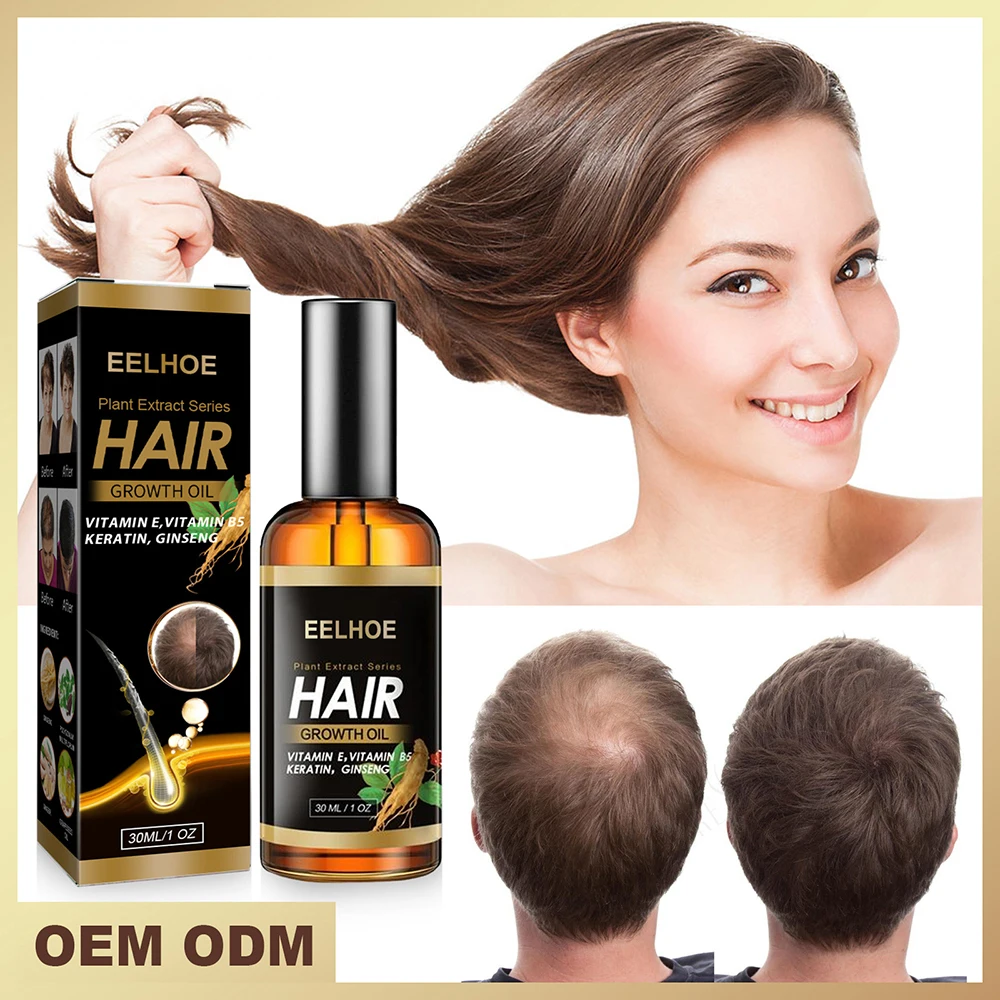 

Имбирное масло для роста волос, гладкое увлажняющее средство для лечения выпадения волос, жидкость для роста волос для мужчин и женщин, пита...