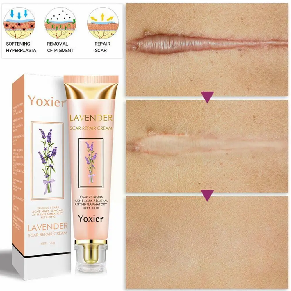 

Lavender Repair Scar Cream Acne Scar Stretch Marks Care Anti-allergic Calm Face Corrector 1pcs Whitening Pigmentation Skin H8l0