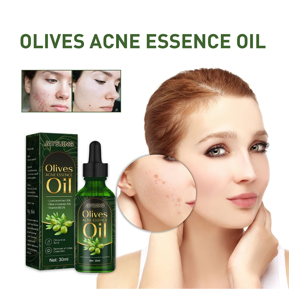 

30 мл масло оливок удаление акне Лечение Эфирное масло баланс влаги и уменьшение жирных шрамов увлажняющий лосьон инструменты для ухода за к...