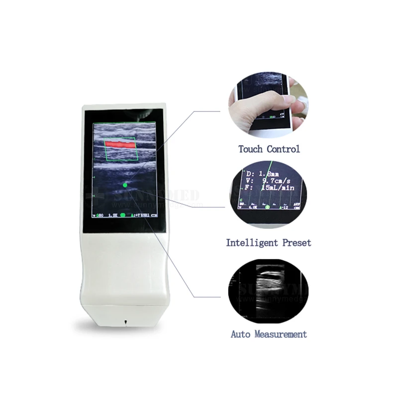 

SY-AC50 Doppler Probe Ultrasound Wifi with screen Mini Android Colorful Wireless Ultrasound Scanner