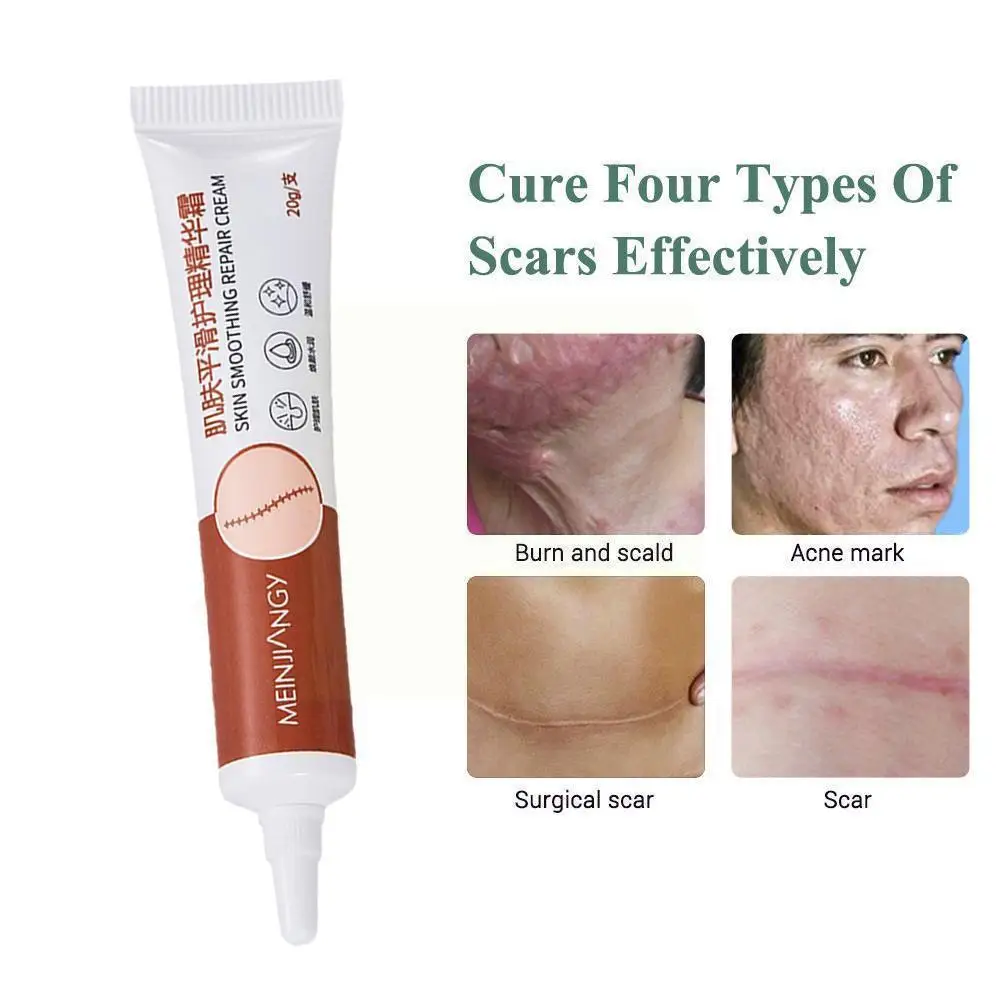 

Scar Acne Removal Cream Faded Stretch Marks Gel Skin Treatment Anti Repair Wrinkle Spots Smoothing Cream Stretch 20g Acne M L7i1