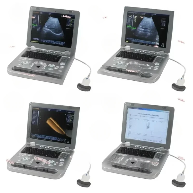 Высококачественное 3D-ультразвуковое медицинское сканирование цифровое