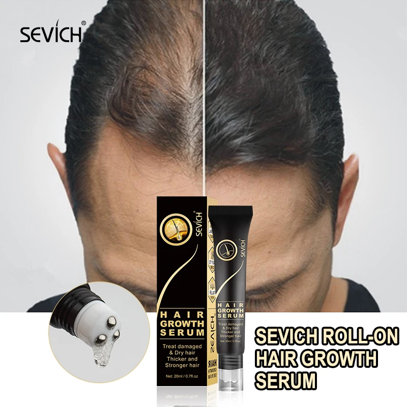 

Sevich Fast Hair Growth Oil 20ml Ginger Extract Growing Hair Oil Anti-Hair Loss Treatment Hair Products for Hair Care and Scalp