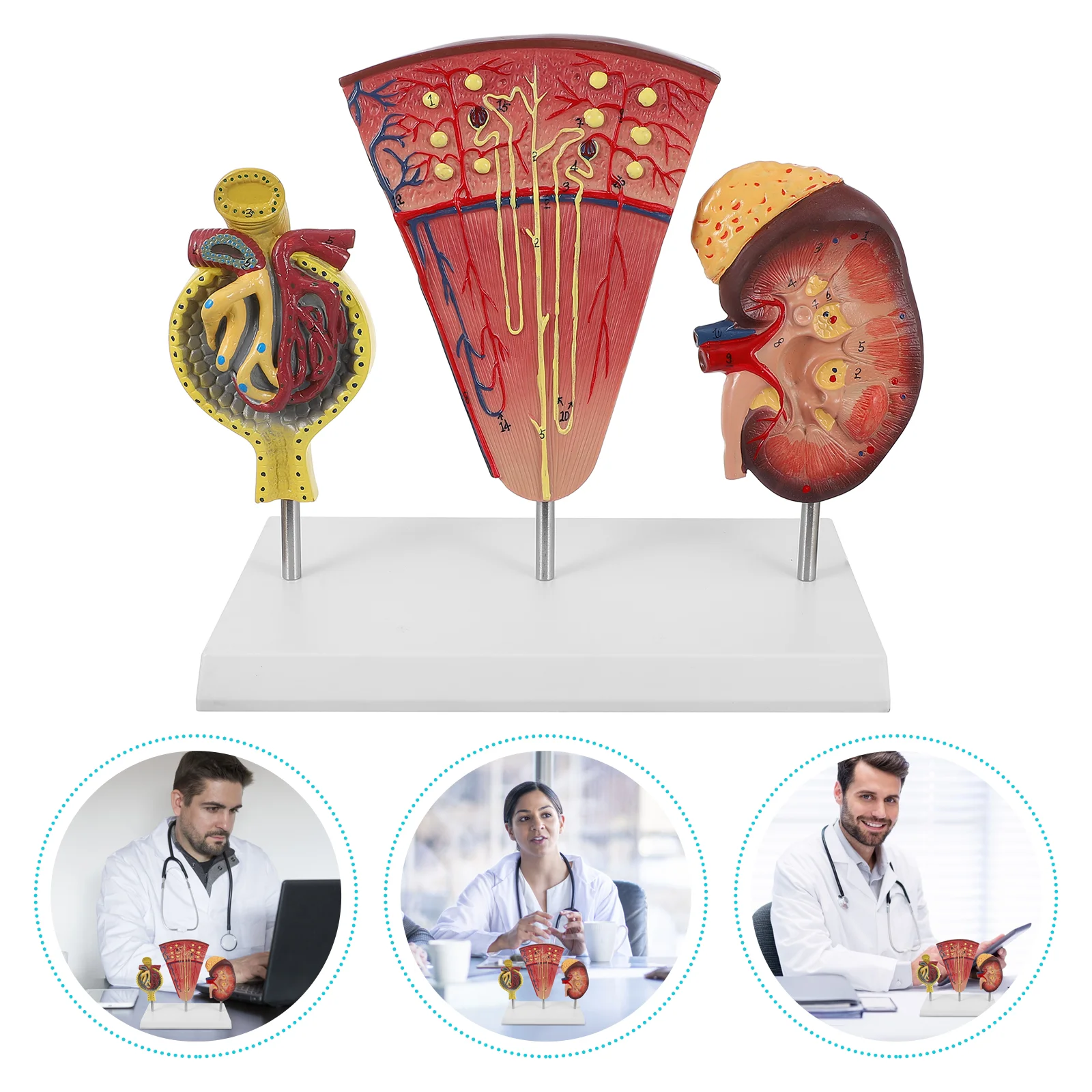 

Anatomical Mode PVC Enlarged Glomeruli Anatomy Model Nephron Model for Study Students