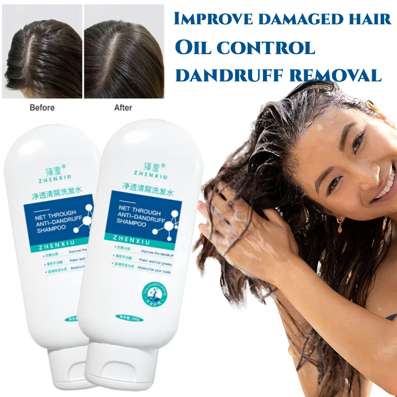 

Anti-dandruff Anti-itch Shampoo Oil Control Improve Dryness Frizz and Fluffiness Prevent Hair Loss Repair Damaged Hair Shampoo