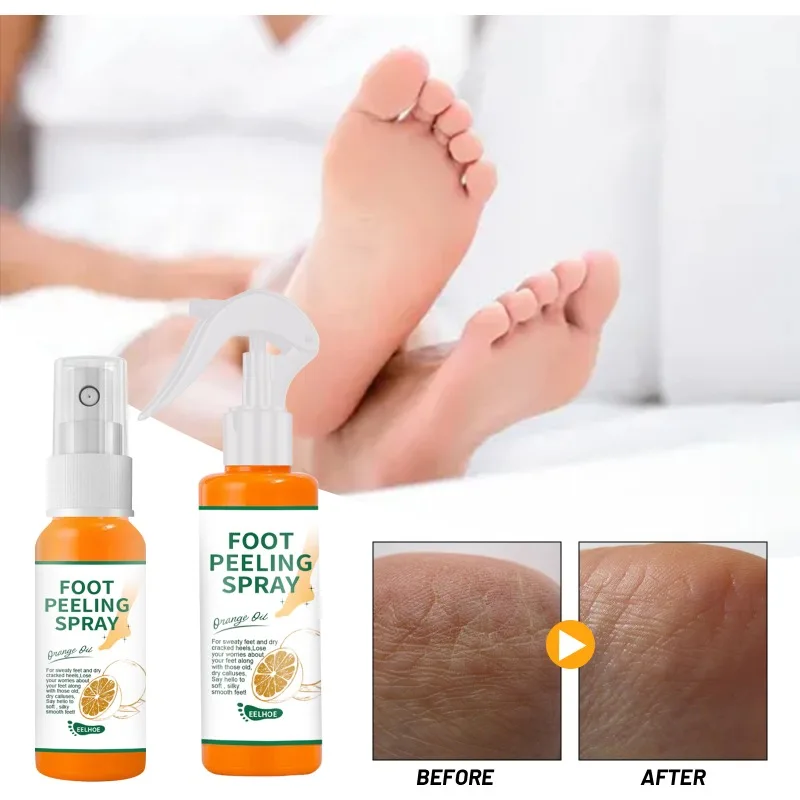 

30/100ml Foot Peeling Spray Natural Orange Essence Pedicure Foot Hand Dead Skin Exfoliator Whiten Foot Care Tool Japan Cosmetics