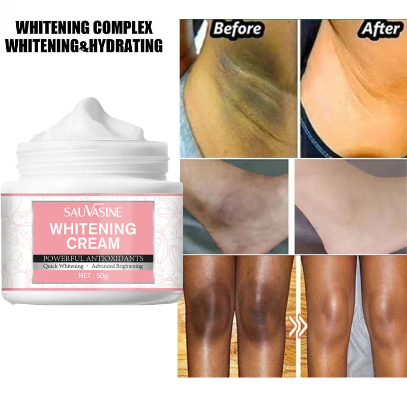 

Body Whitening Cream Armpit Dark Skin Lightening Intimate Areas Underarm Care Private Parts Skin Whiten Cream Beauty Health 50g