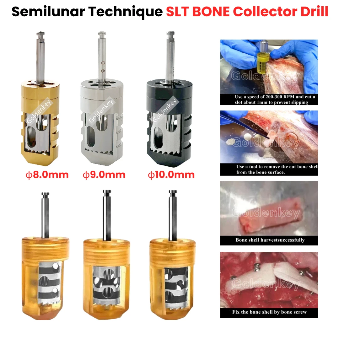 Фото Стоматологический SLT Easy Bone Collector Полумесячная техника GBR SLT Дрель Имплантат Полумесячная оболочка Аргенментация костей Урожай EBC HalfMOON №1