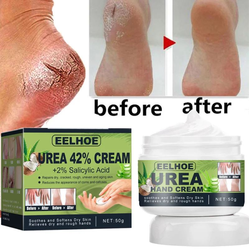 

Anti Crack Foot Cream Heel Cracked Repair Moisture Hand Mask Smooth Removal Dead Skin Callus Anti-Drying Hand Feet Skin Care 50g