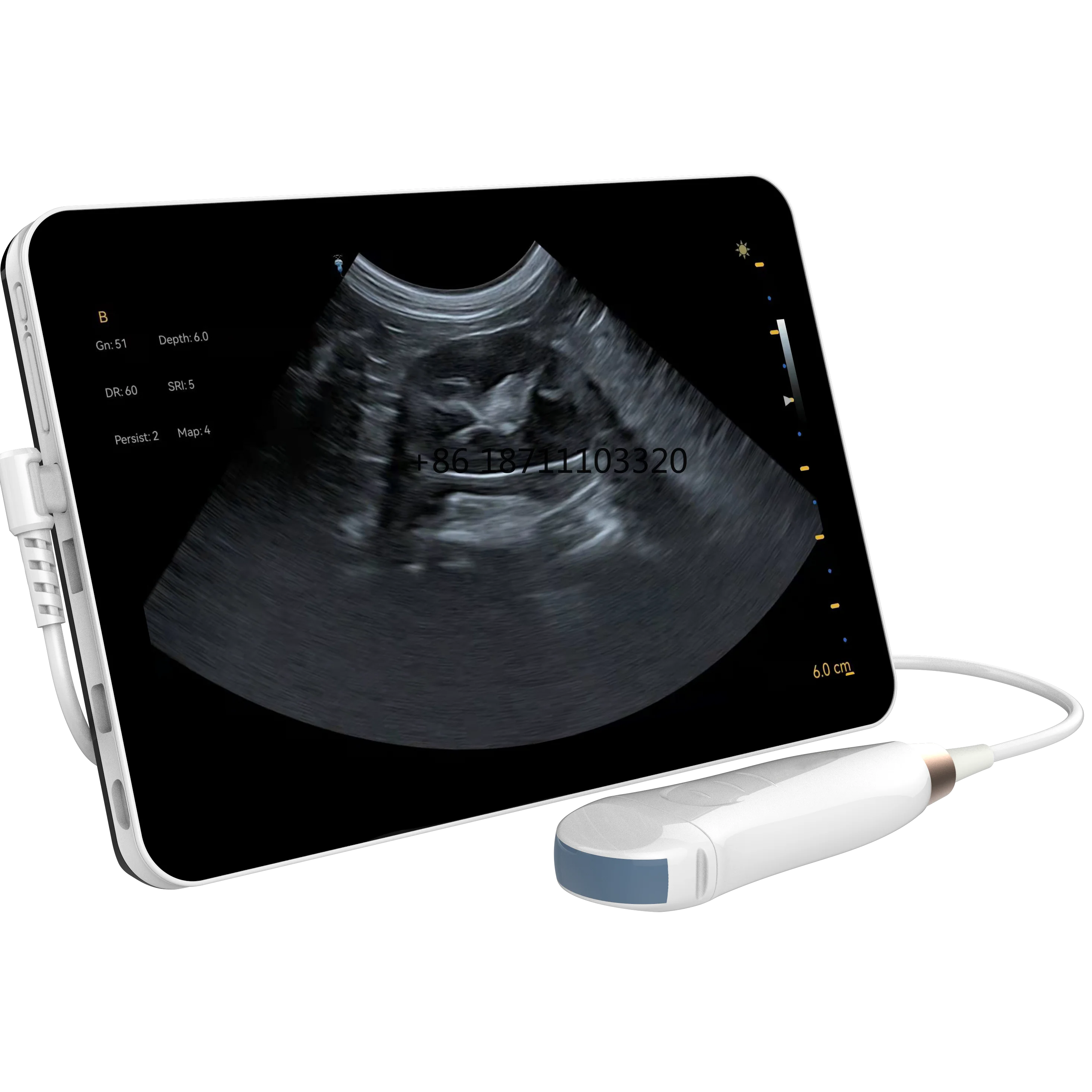 Компактное портативное ручное цифровое ультразвуковое диагностическое