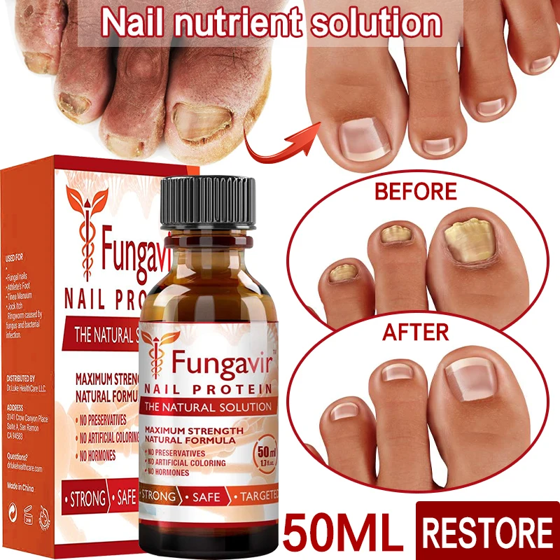 

50ml Nail Repair Essence Serum Anti Fungal Nail Treatment Remove Onychomycosis Nourishing Brighten Hand Foot Toes Nail Care