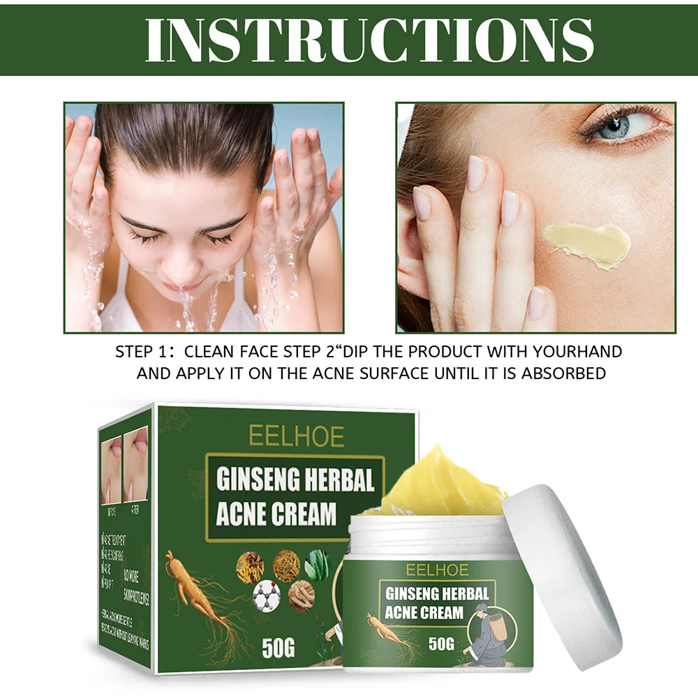 

10/20/30/50g Effective Acne Removal Cream Treatment Acne Scar Shrink Pores Oil Control Whitening Moisturize Face Cream