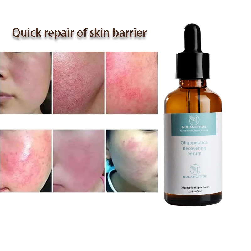 

Oligopeptide-1 Repairing Face Serum Moisturizing Stock Solution Acne Pimples Scars Shrink Pore Day Night Essence Skin Care