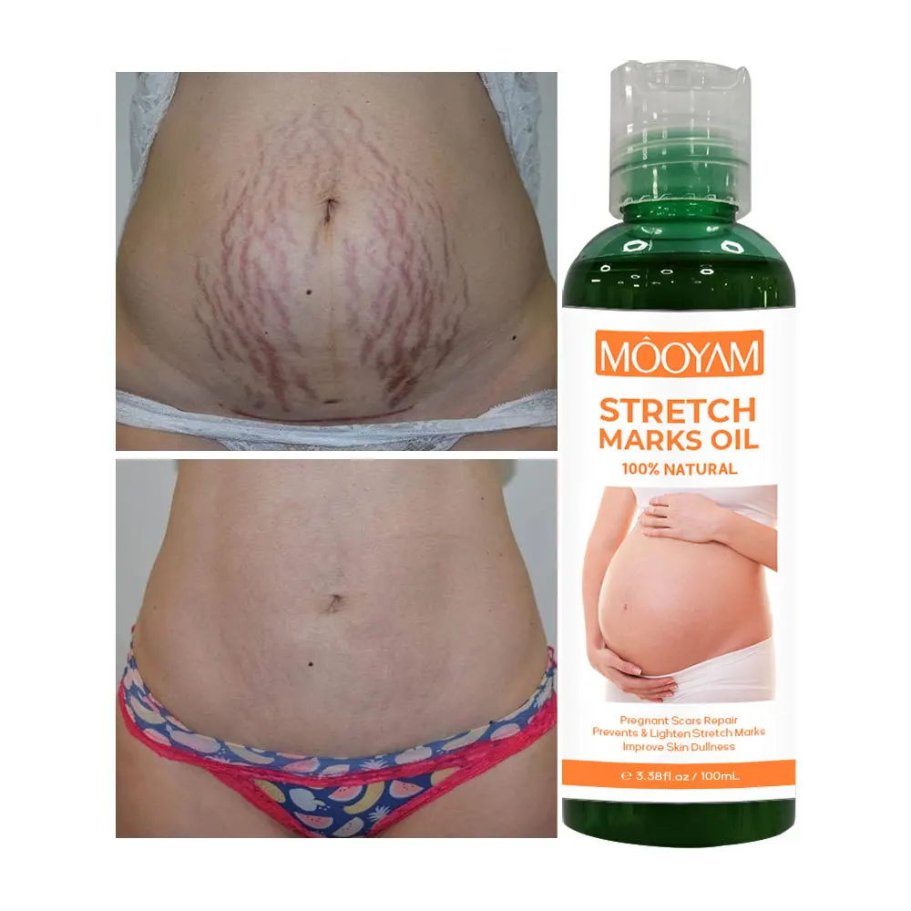 

100ml Pregnancy Oil Postpartum Repair&Remove Pregnancy Marks Oil Firming Body Massage Oil Body Skin Care