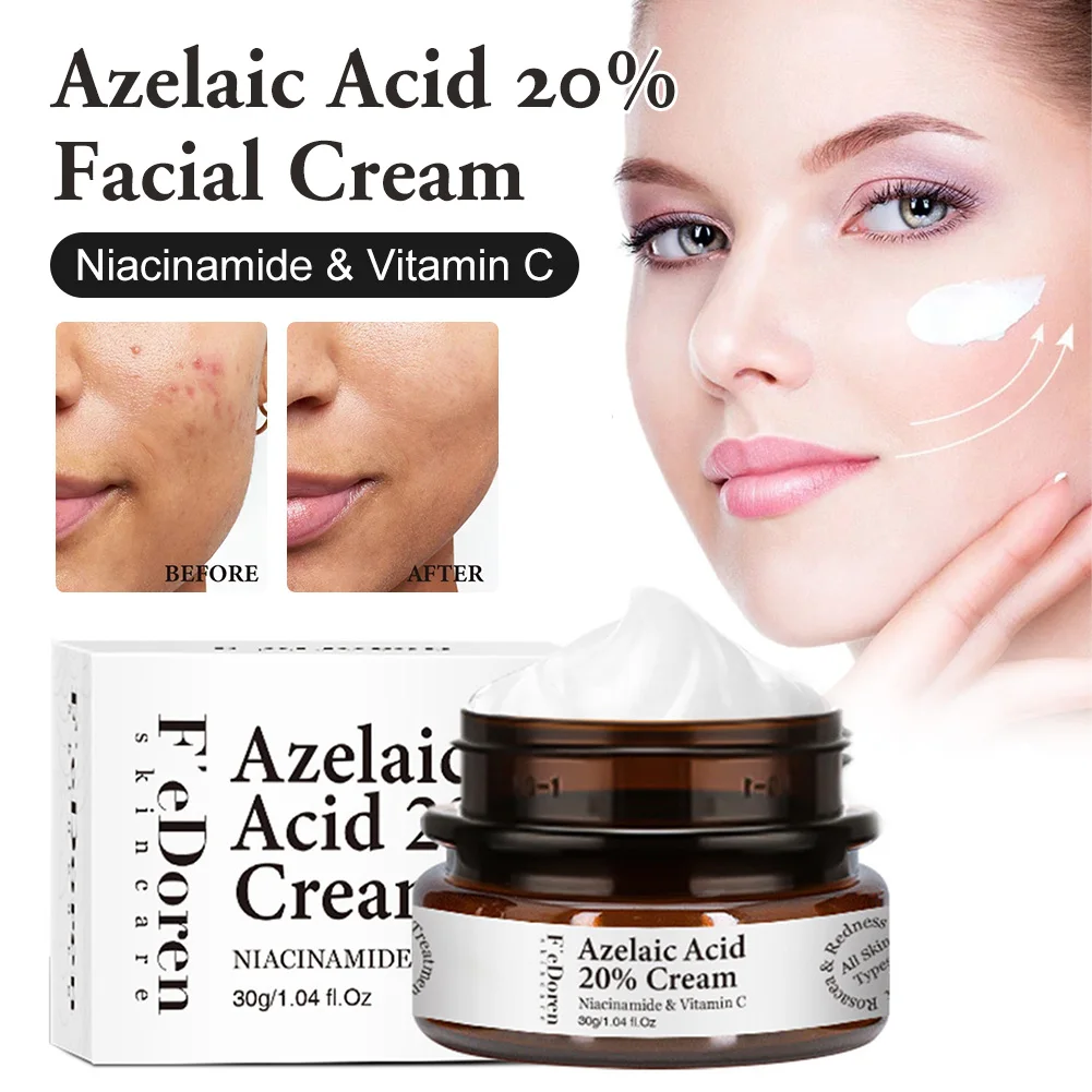 

30ml Azelaic Acid 20% Facial Cream Remove Dark Spots Acne Fine Lines Whiten Skin Face Whitening Moisturizing Cream Skin Care