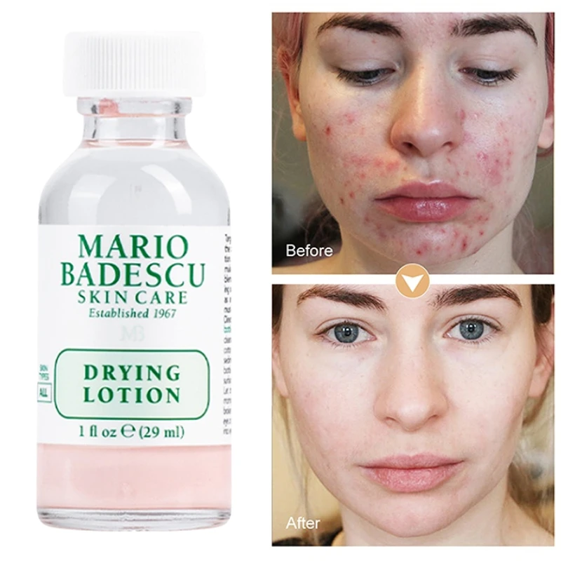 

MB Powder-bottle Effective Acne Treatment Original Mario Badescu Drying Lotion Anti Acne Serum Pimple Blemish Removal Skin Care