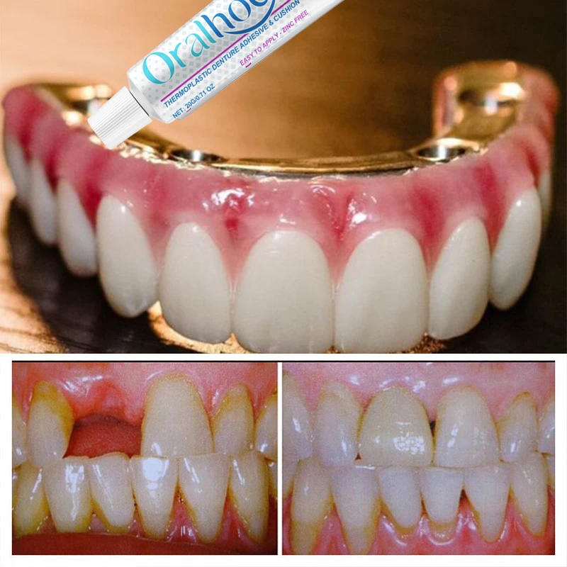 Термопластичный клей для зубных протезов и подушечка уменьшает боль в десен