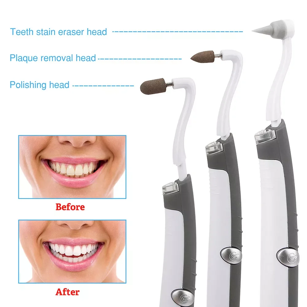 

Ultra-Sonic Acoustic Vibration Tooth Cleaner Scaler Tooth Calculus Remover Teeth Stains Tartar teeth Whitening
