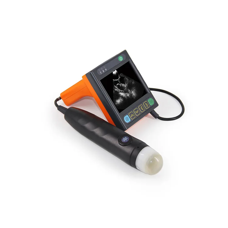 Дешевая электронная ультразвуковая машина со стандартным цифровым механическим