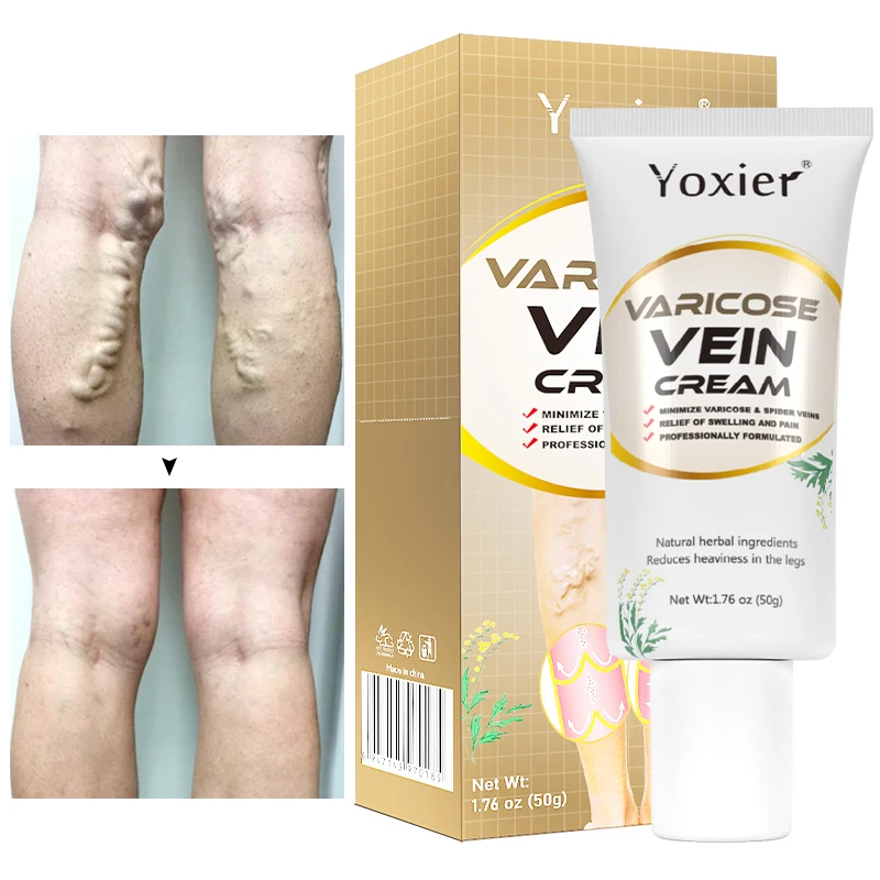 

New Herbal Varicose Vein Repair Cream Soothing Pain Relief Cream Phlebitis Spider Vein Improves Blood Circulation Legs Care 50g