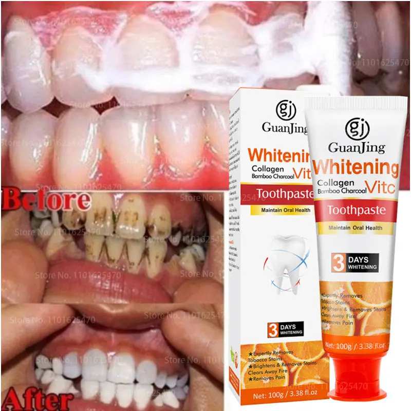 

100ml Quick Cavity Repair Caries Filling Removal Plaque Stains Caries Whitening Yellowing Teeth Whitening Repair