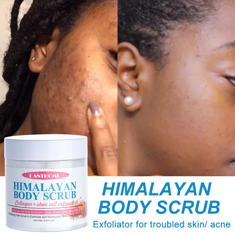 

Himalayan Salt Scrub Body Scrub Cream Facial Dead Sea Salt For Exfoliating Whitening Moisturizing Anti Cellulite Treatment Acne