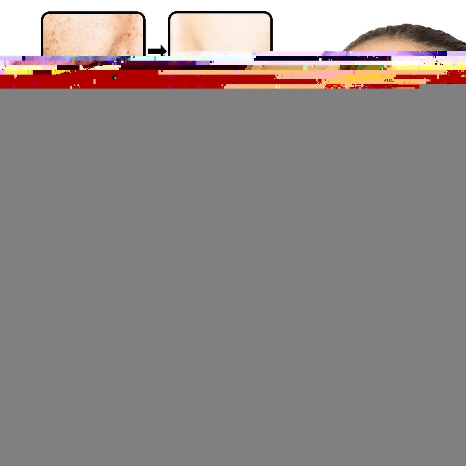 

20g Remove Dark Spots Anti Freckle Cream Effective Whitening Brightening Skin Repair Anti-Aging Moisturizing Cream Skin Care