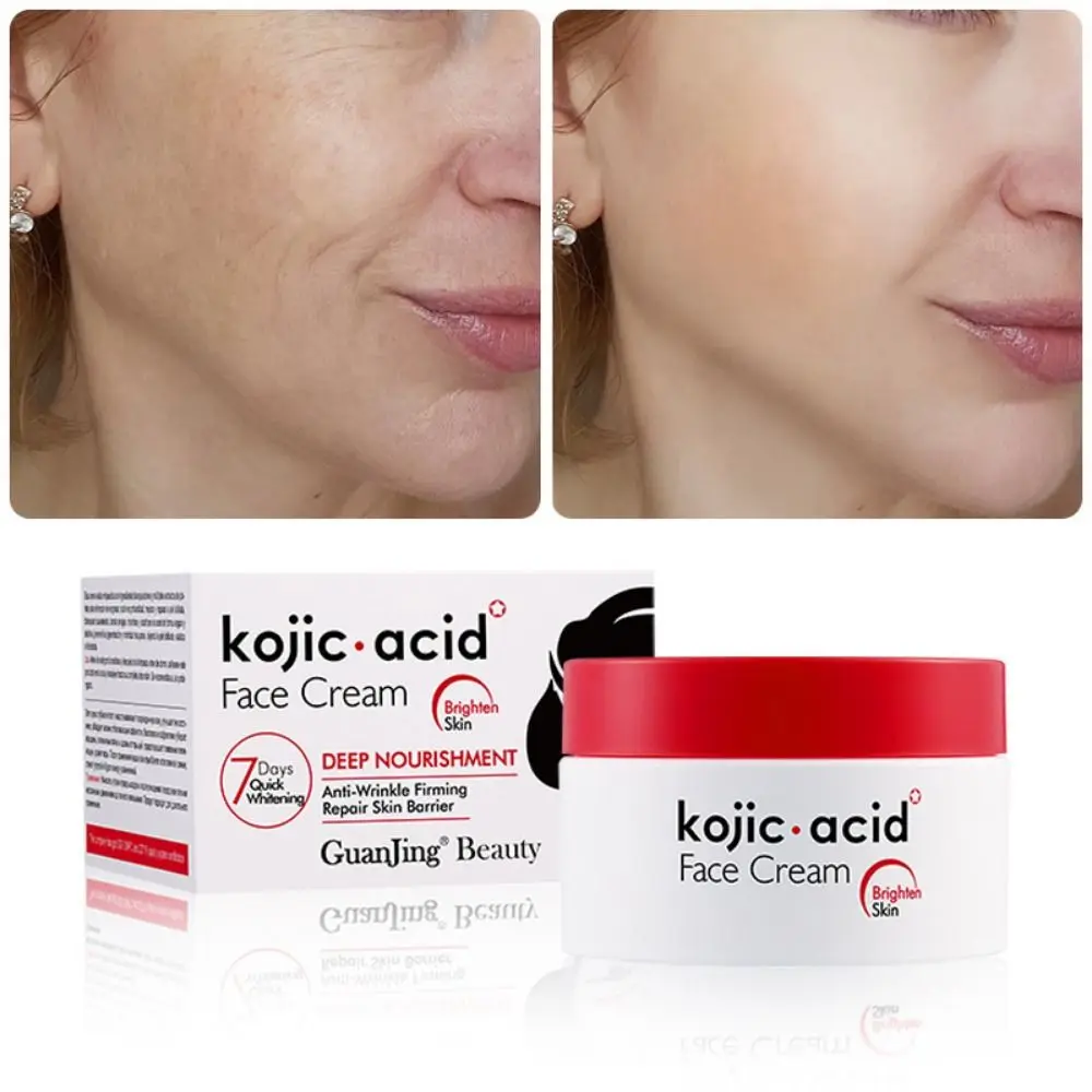 

Moisturizing Kojic Face Cream Hydrating Brighten Skin Dark Spot Corrector Cream 50g Improve Dull Skin Removal Freckle Cream