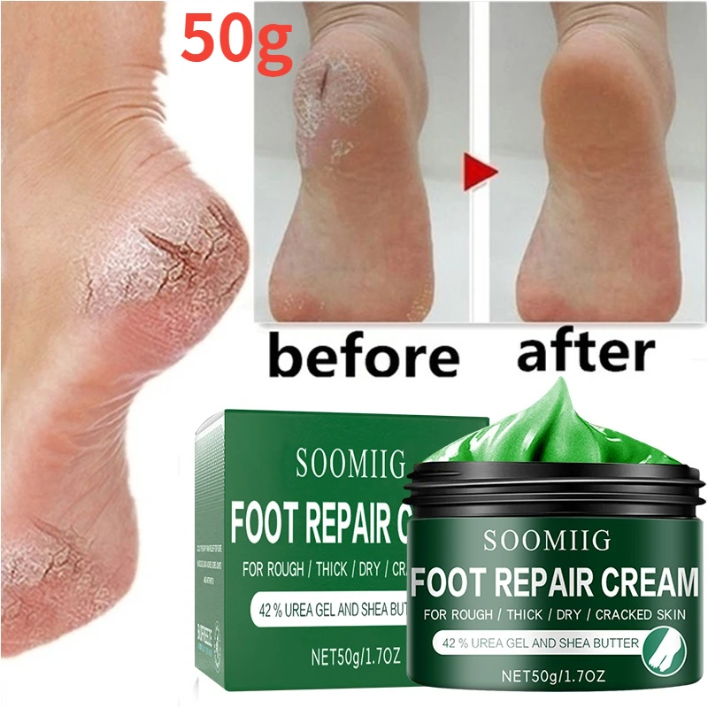 

2022 Effective Odor Treatment Nourishing Anti Cracking Cream Skin Care Products Dead Skin Remover Chapped Repair Cream