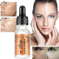 removing tattoos lightening spots herbal extracts nourishing skin dark spots serum freckles facial warts rose oil